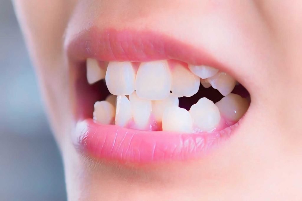 Fix malocclusion with orthodontic treatments from our family dentists in Weddington, near Wesley Chapel and Waverly, NC.