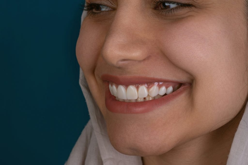 Can I Get Veneers If My Natural Teeth Are Crooked?
