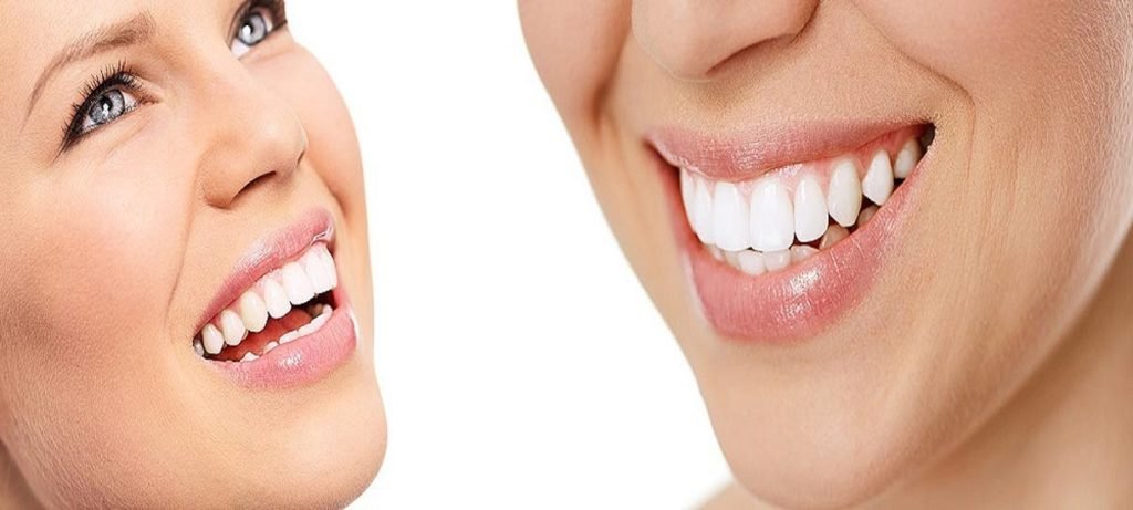 When Teeth Whitening Isn't For You: Risks, Alternatives & Safe Choices